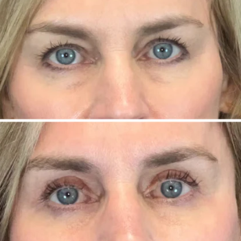 InstantGlow Collagen Eye Patches