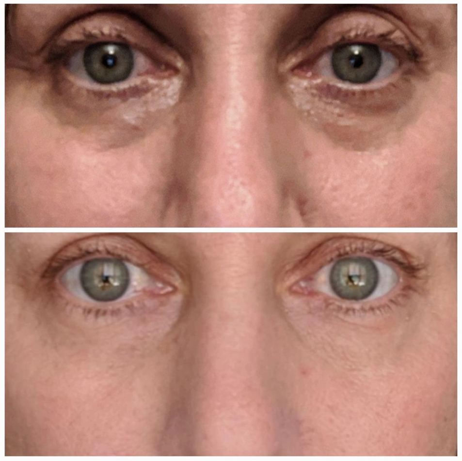 InstantGlow Collagen Eye Patches