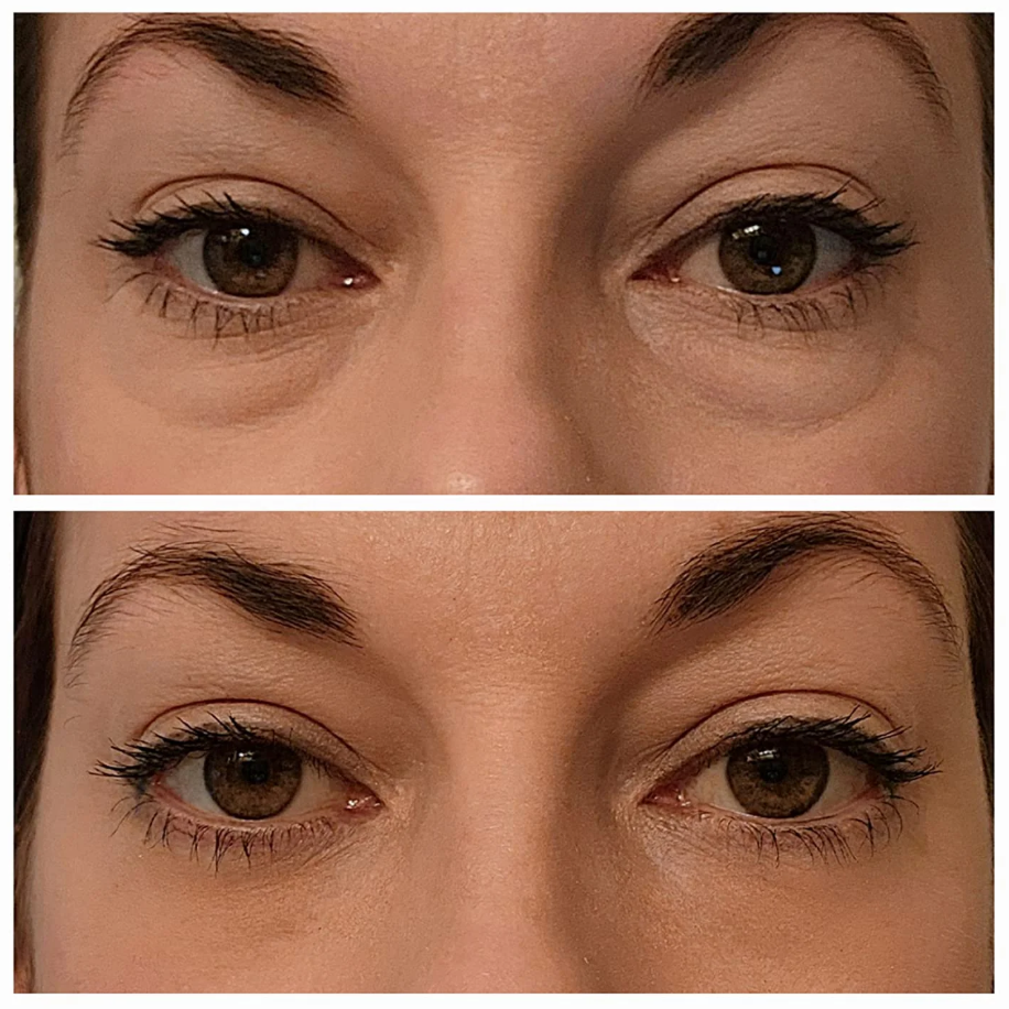 InstantGlow Collagen Eye Patches