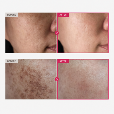 Advanced Korean Arbutin Brightening Cream