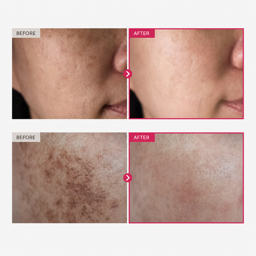 Advanced Korean Arbutin Brightening Cream