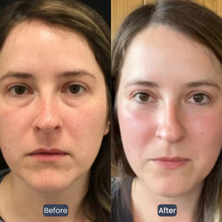 Collagen-Infused Tightening Eye Patches