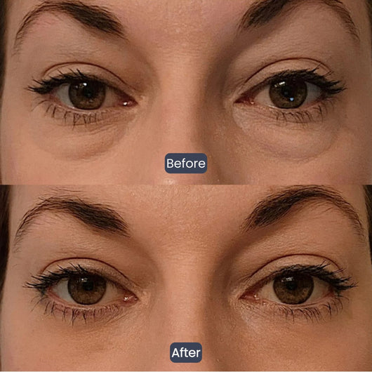 Collagen-Infused Tightening Eye Patches