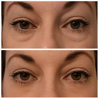 InstantGlow Collagen Eye Patches